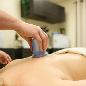 Stationary & Dynamic Cupping