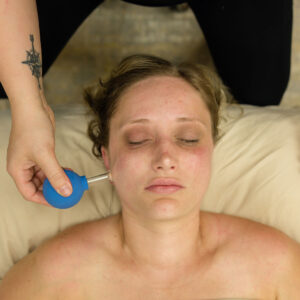 Facial Cupping